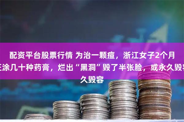 配资平台股票行情 为治一颗痘，浙江女子2个月狂涂几十种药膏，烂出“黑洞”毁了半张脸，或永久毁容